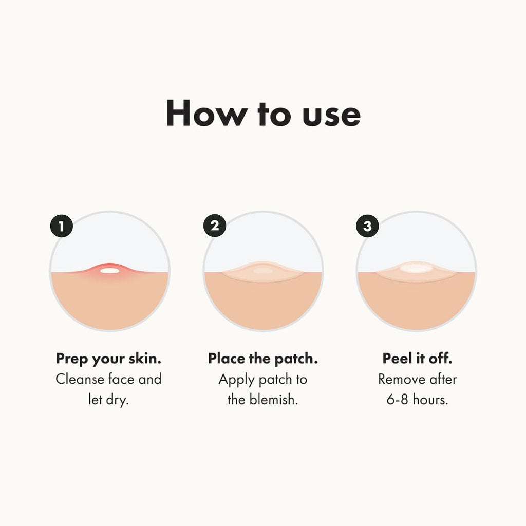 Mighty Patch™ Original patch from Hero Cosmetics – The #1 Hydrocolloid Acne Pimple Patch for Shrinking Zits and Whiteheads in 1 use; Nighttime Spot Stickers for Face and Skin (75 Count)