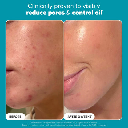 Paula's Choice SKIN PERFECTING 2% BHA Liquid Salicylic Acid Exfoliant-Facial Exfoliant for Enlarged Pores, Wrinkles & Fine Lines, Suitable for Blackhead-Prone Skin, Fragrance-Free